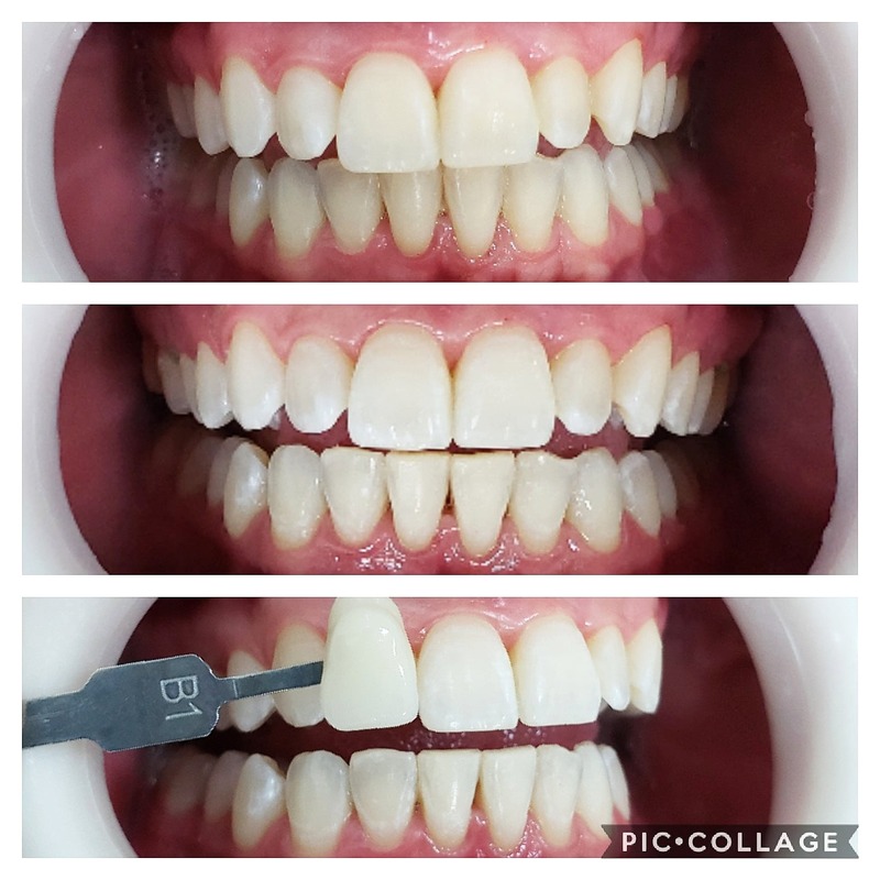 Foto da galeria Oral Vita 18